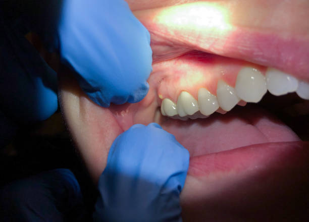 Best Pediatric Emergency Dentist in Dubois, PA