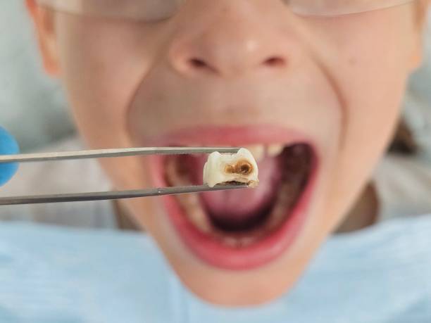 Best Emergency Dental Extractions in Dubois, PA